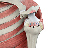 Arthroscopic Rotator Cuff Repair